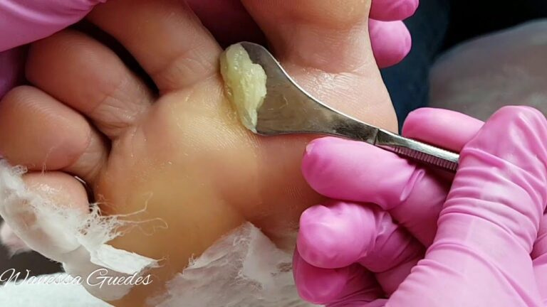 👣 Curso de Plástica e Spá dos Pés – CoEditora | Tendência em Estética e Autocuidado